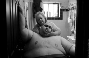 A Life Apart: The Toll of Obesity 1