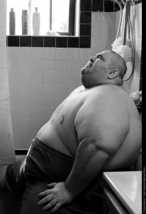 A Life Apart: The Toll of Obesity